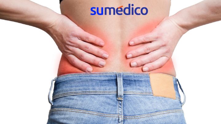 ¿Qué son los cálculos renales y cómo prevenirlos?
