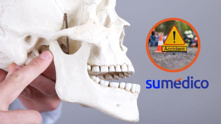 Médicos unen la cabeza de un niño a su cuerpo tras un accidente