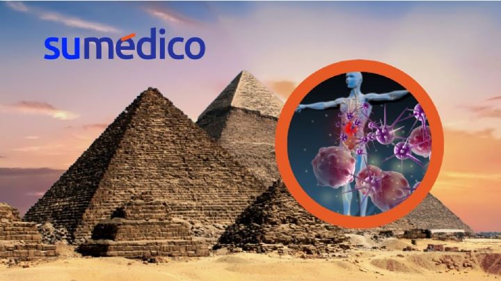 Monitorean extraña enfermedad que ha contagiado a más de 250 personas en Egipto