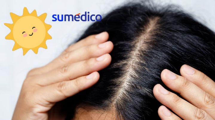Cuida tu cuero cabelludo en verano con estos consejos 	