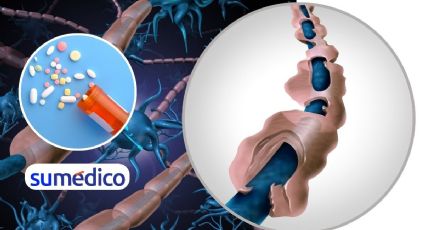 OMS integra fármacos contra esclerosis múltiple en su lista de medicamentos esenciales