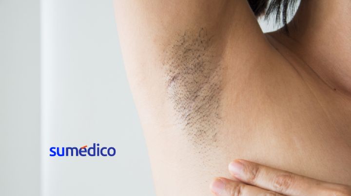 Conoce este remedio casero para quitar las manchas de las axilas