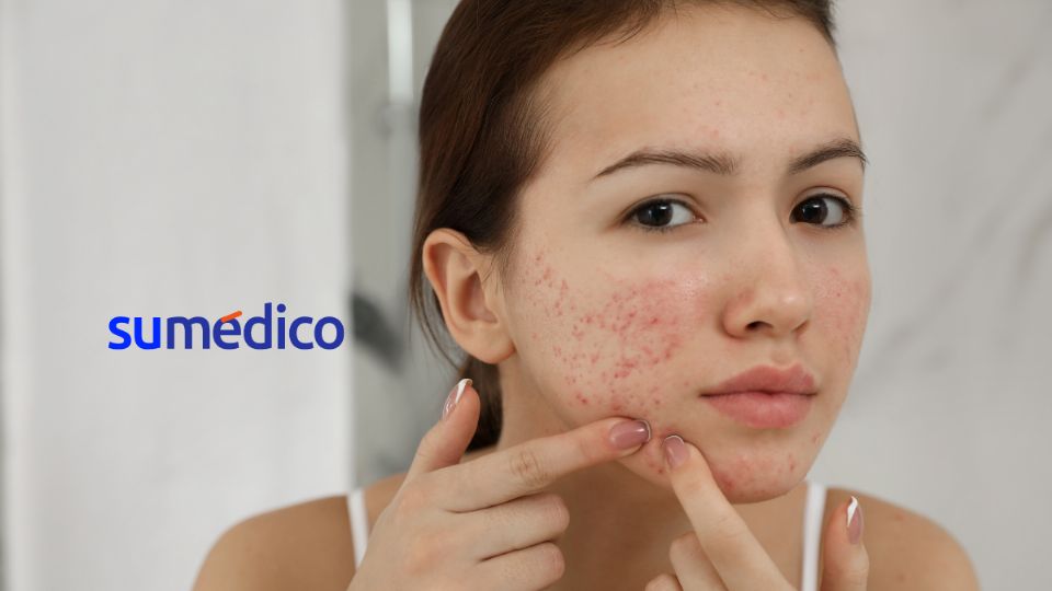 La Fundación Mexicana para la Dermatología realizará una jornada de salud gratuita