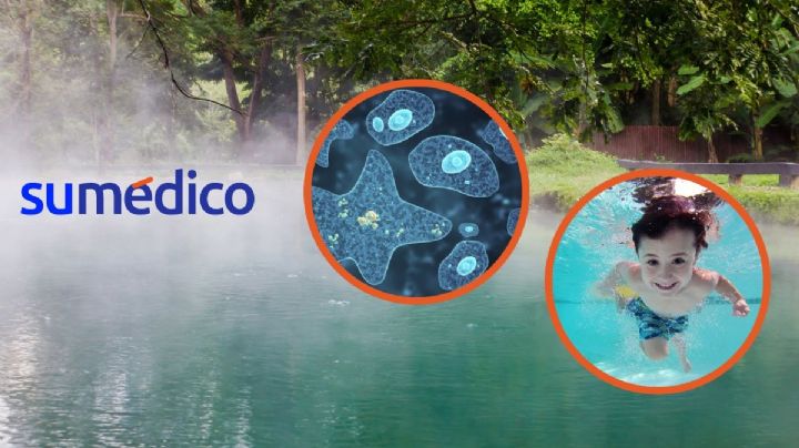 Ameba ‘comecerebros’ ocasiona la muerte de niño de 2 años. ¿Dónde encontrarla?