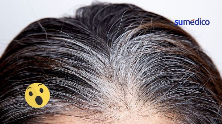 5 consejos para evitar que las canas se vuelvan amarillas
