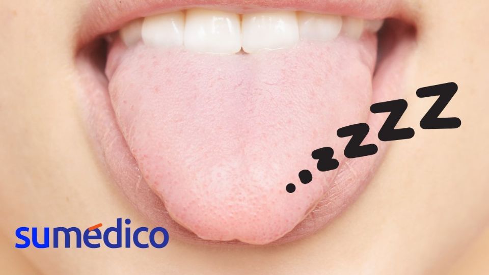 ¿Lengua dormida? Conoce algunas de sus causas y evita riesgos en tu salud.