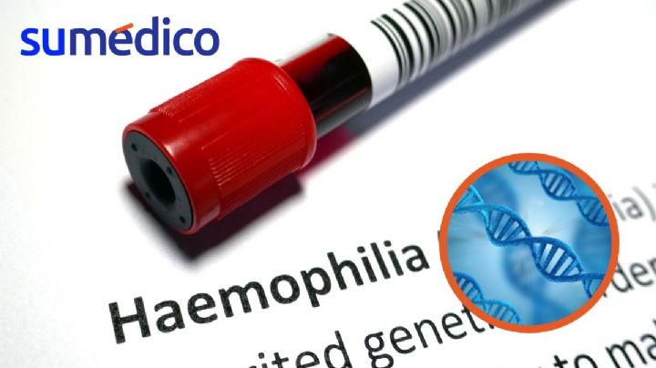 Roctavian: primera terapia génica para hemofilia A grave aprobada por FDA
