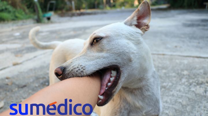 Enfermedades que los animales pueden transmitir a los humanos
