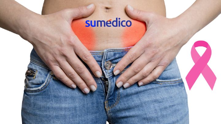 ¿Padecer cáncer de mama aumenta la probabilidad de sufrir cáncer de ovario?