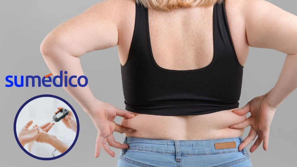 Voltear a ver los genes para entender la obesidad abdominal, así lo propone este estudio.