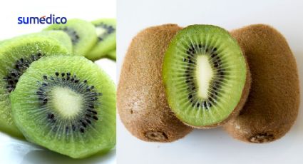 ¿Es bueno comer un kiwi todos los días?