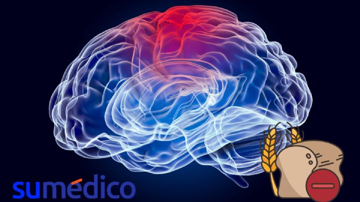 ¿Cómo el gluten puede afectar al cerebro?