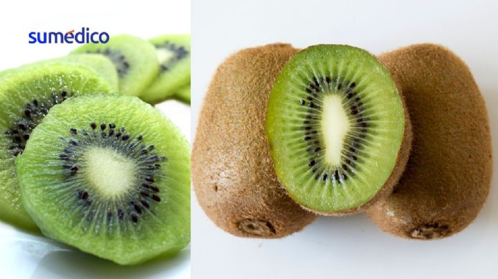 ¿Es bueno comer un kiwi todos los días?
