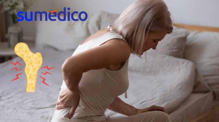 ¿Qué fruta debes comer para evitar la osteoporosis?