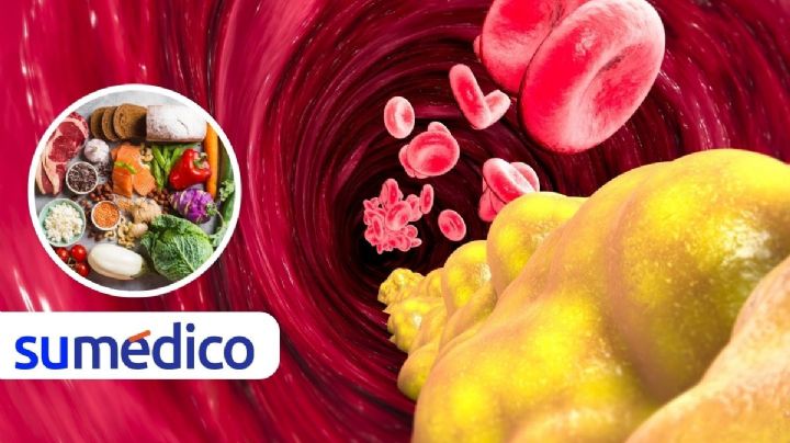 5 alimentos para incluir en la cena y controlar los triglicéridos altos