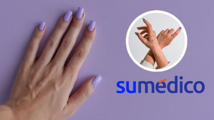 Uñas semipermanentes: 5 signos que te avisarán si tienes alergia a ellas