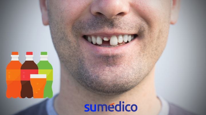Bebidas que dañan tus dientes y es mejor evitarlas