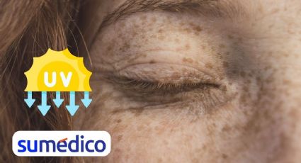 Protege tus pecas contra los rayos del sol con estos 5 consejos