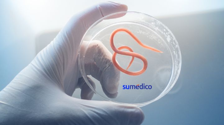Cirujanos extraen una lombriz intestinal viva de 8 centímetros del cerebro de una mujer