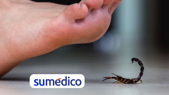 Estos trucos caseros te ayudarán para ahuyentar los alacranes de tu casa