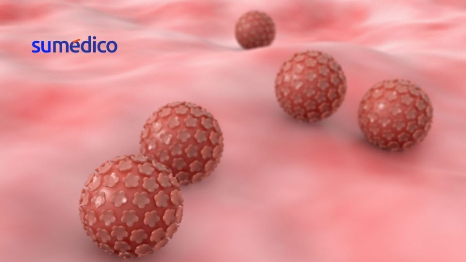 El principal subtipo del virus que se asocia al cáncer de garganta, incluyendo al cáncer orofaríngeo es el VPH 16