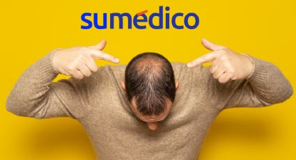 Casi la mitad de los hombres en México sufrirá de alopecia ¿se puede prevenir?