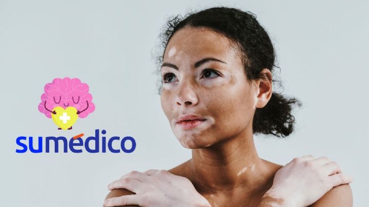 Body shaming: cómo afecta el burlarse de los cuerpos a la salud mental
