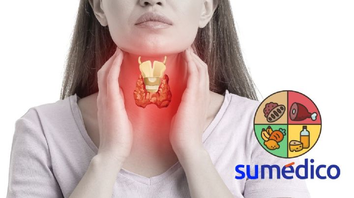 Estos alimentos deben evitarse si vives con alguna enfermedad de la tiroides
