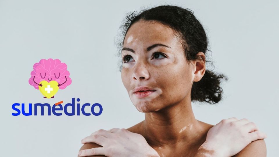 ¿Qué es el body shaming? ¿Cómo actuar frente a ello?