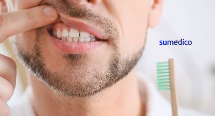 Descubren nueva forma de prevenir la gingivitis, según Universidad de Cincinnati