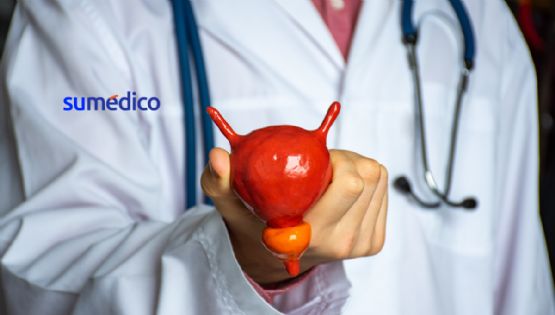 Practica estos 4 hábitos para cuidar la próstata