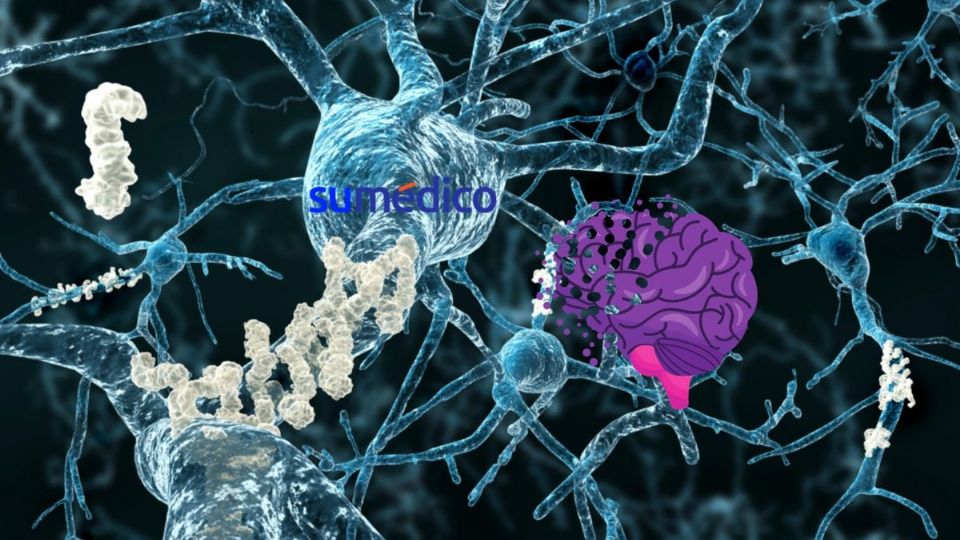 La enfermedad del Alzheimer mata a las neuronas.