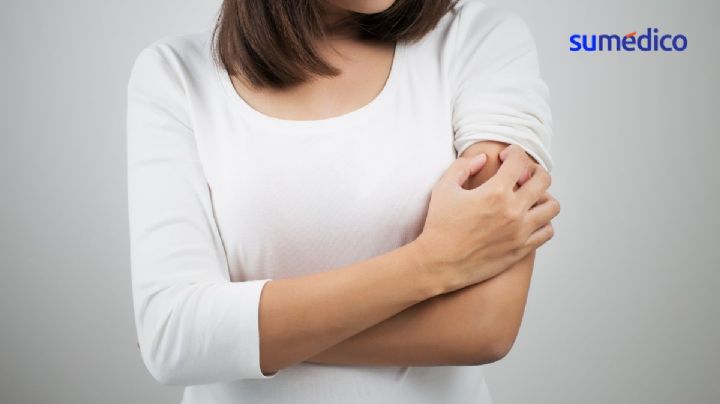 ¿Qué hacer para mejorar el malestar de la dermatitis?