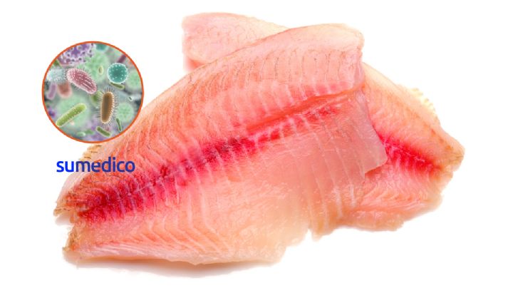 Tras comer pescado tilapia infectado, le amputan extremidades a mujer