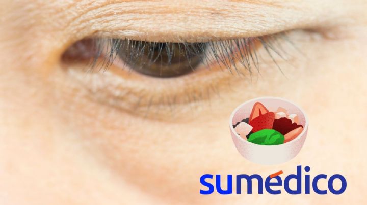Elimina las bolsas debajo de los ojos con esta vitamina que puedes encontrar en diversos alimentos