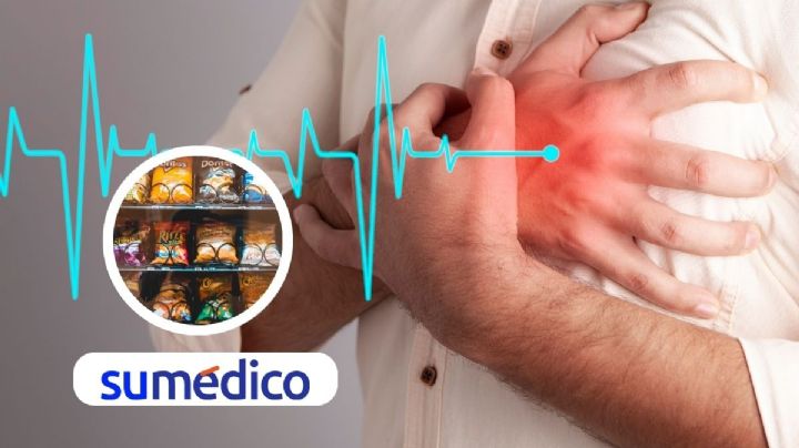 Reducir el sodio de alimentos procesados evitaría más de 12 mil muertes anuales en México