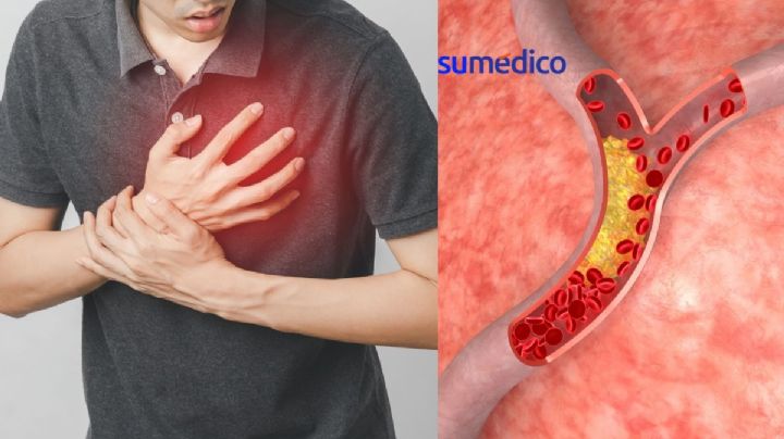Cada 2 minutos muere un mexicano por enfermedad cardiovascular; colesterol alto es un factor