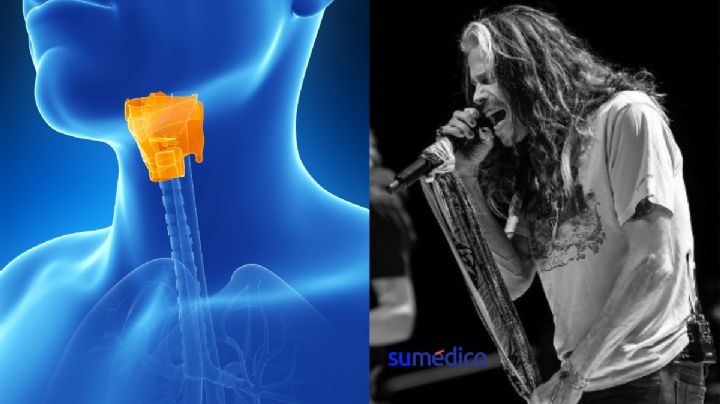 ¿Qué es la fractura de laringe como la que padece Steven Tyler, de Aerosmith?