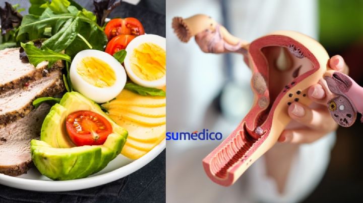¿Cuál es la mejor dieta para controlar el ovario poliquístico?