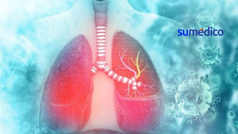 La fibrosis quística es una enfermedad hereditaria y se estima que entre 200 y 300 personas nacen con ella cada año.