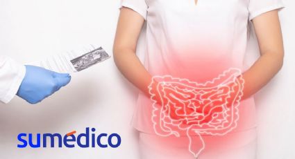 ¿Cómo limpiar el colon rápido y efectivo? Utiliza estos ingredientes que tienes en tu casa