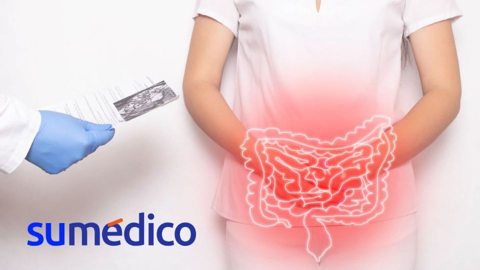 ¿Qué te puede ayudar para un colon sucio? Conoce este remedio natural.