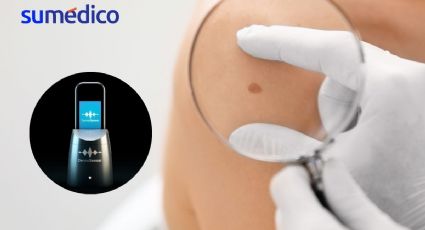 ¿Cómo es el dispositivo de IA que la FDA aprobó para detectar el cáncer de piel?