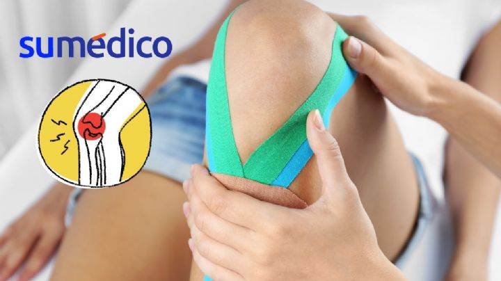 ¿Qué es el vendaje neuromuscular y para qué sirve?