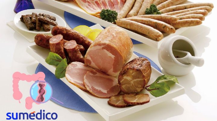 Carne procesada incrementa el 18% de riesgo de cáncer colorrectal: especialista