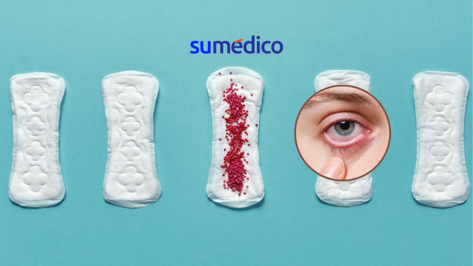 La menstruación vicaria puede presentar sangrado menstrual a través de los ojos