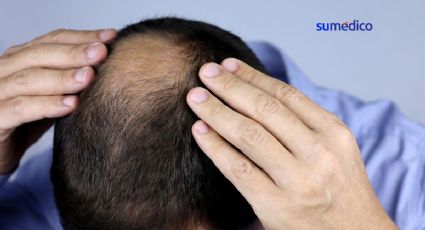 5 razones por las que se cae el cabello