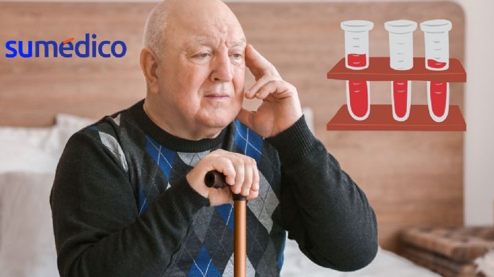 ¿Se puede detectar el Alzheimer a través de una prueba de sangre?