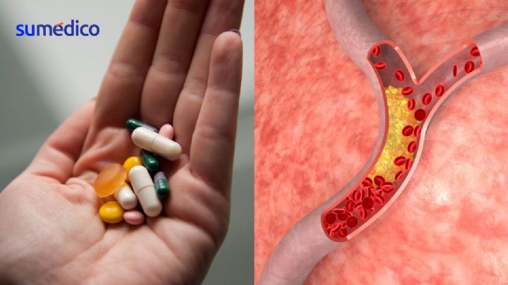 Estos son los riesgos de dejar los medicamentos para el colesterol