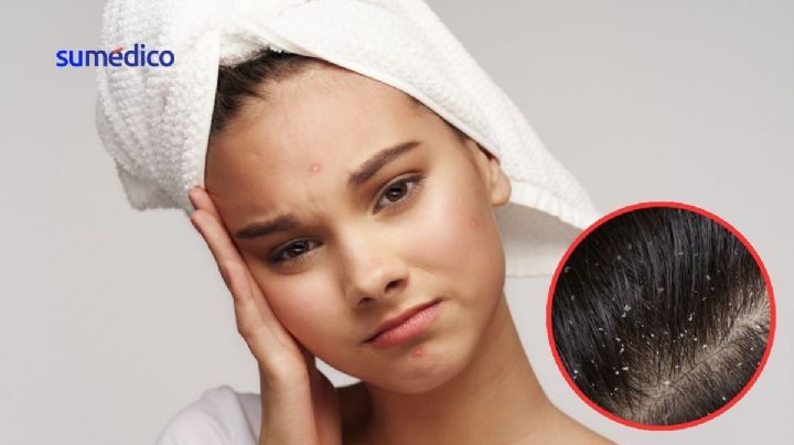 ¿Qué pasa si me duermo con el pelo mojado? 5 consecuencias